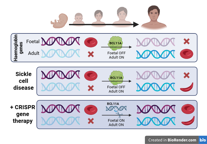 Hb genes CRISPR therapy
