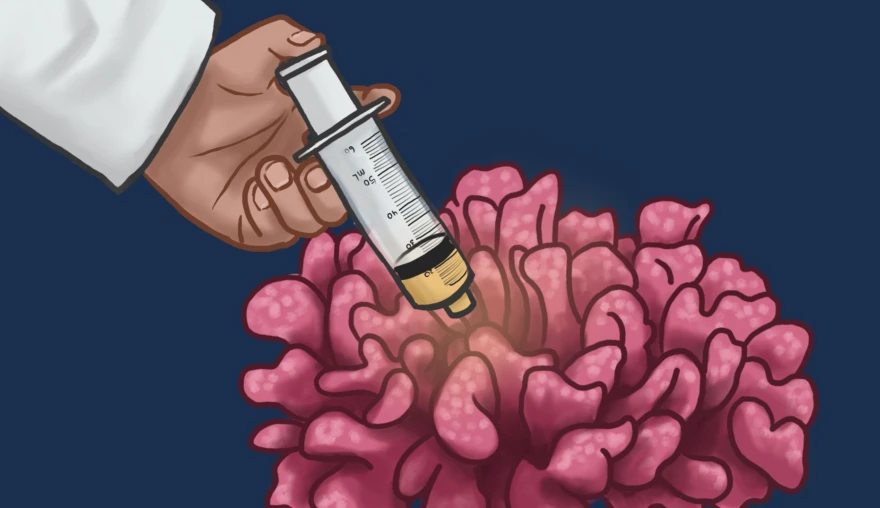Microbioom Makeover – Een Mogelijke Behandeling voor Koraalverbleking?